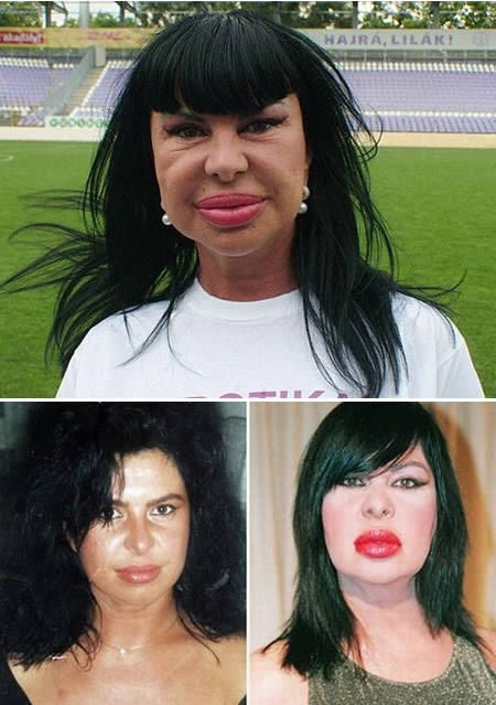 12 Worst Plastic Surgery Makeovers Huffpost