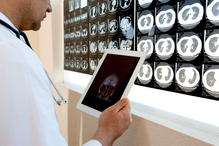 Doctor examining MRI scans and using a digital tablet