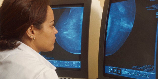 Photo Essay From Hospital. Digital Mammography. Mammography Unit Of The Gustave Roussy Institute, In The French Region Of Ile De France. Doctor. (Photo By BSIP/UIG Via Getty Images)