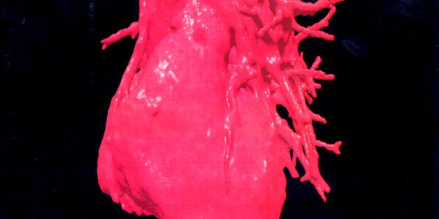 F367684 05: A Three-Dimensional (3-D) Image Displays A Computerised Visualization Of A Human Heart. These Images Were Reconst