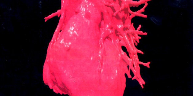 F367684 05: A Three-Dimensional (3-D) Image Displays A Computerised Visualization Of A Human Heart. These Images Were Reconstructed From A Formatted Ct Scan, Using Ross.Ct Software At The Ames Center For Bioinformatics At Nasa Ames Research Center September 1998 In Moffett Field, Ca. One Of The Goals Of The Project Is To Develop A Virtual Environment Workbench For Planning Complex Craniofacial Reconstructive Surgery And Other Surgeries. This Nasa Technology Will Enable Surgeons To Plan Complex Surgical Procedures And To Visualize The Potential Results Of Reconstructive Surgery In A Three-Dimensional Virtual Environment Simulator. (Photo By Nasa/Getty Images)