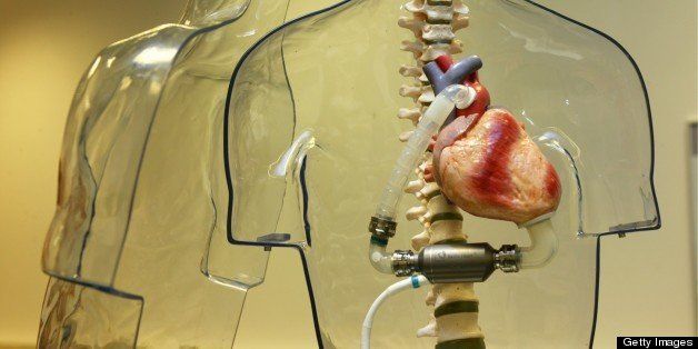 GERMANY - MAY 03: Model in original size of a Incor-artificial heart of the Berlin Heart company, Berlin Heart has a EC-concession for Incor, An artficial heart which can be implanted in the human body. (Photo by Ulrich Baumgarten via Getty Images)