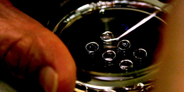 UNITED STATES - MARCH 24: Embryologist Ric Ross places human embryos onto a petri dish at the La Jolla IVF Lab in La Jolla, California, U.S., on Tuesday, March 24, 2009. President Barack Obama earlier this month lifted restrictions on federal funding for embryonic stem-cell research and called on Congress to provide more money for such study to make the U.S. a leader in the field. (Photo by Sandy Huffaker/Bloomberg via Getty Images)