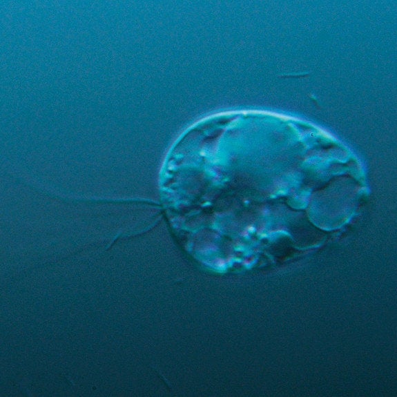 One Celled Organism >> Collodictyon One Celled Organism Found In Norway Called Man S One Celled Organism >> Collodictyon One Celled Organism Found In Norway Called Man S