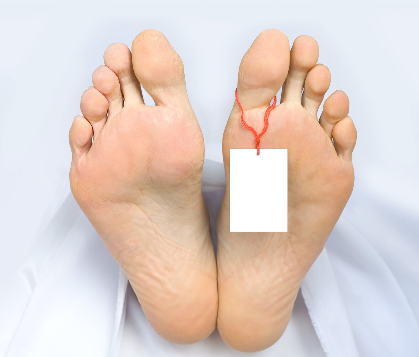 Stem Cells From Corpses? Living Cells Can Be Harvested From Bodies ...