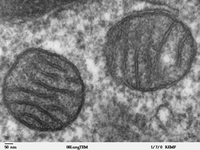 The high magnification image shows a mitochondria. JEOL 100CX TEM | Source. http://remf. dartmouth. edu/imagesindex. html. http://remf. ... 