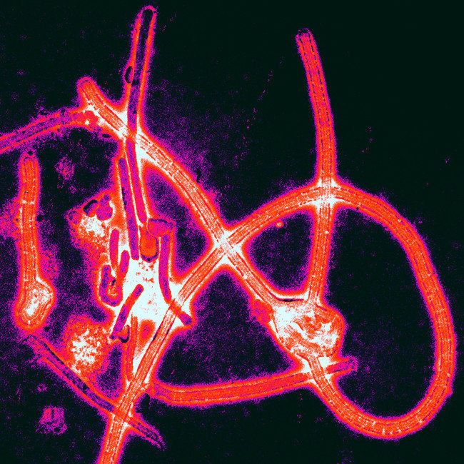 Description 1 Color-enhanced electron micrograph of Ebola virus particles. 1 Mikrofotografia elektronowa cząsteczek wirusa Ebola w ... 