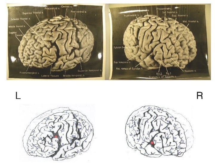 Albert Einstein's Brain: 12 Facts About Gray Matter Of Scientific Genius  (PHOTOS)