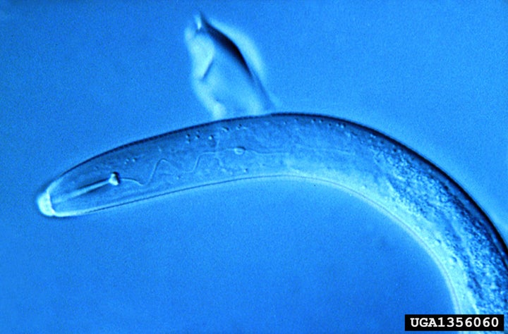 How Do Skin-Penetrating Nematodes Find Your Feet as You Walk Barefoot  Through Soil?