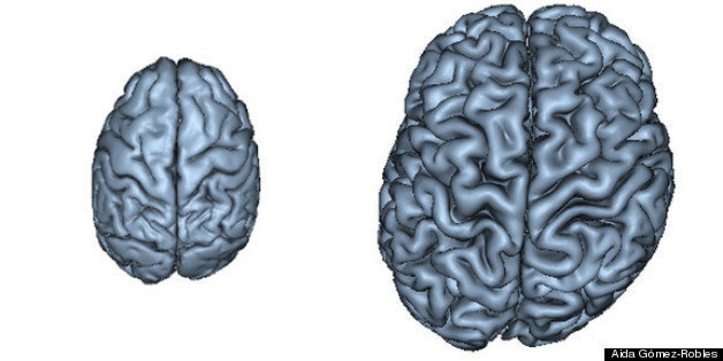 Brain's Asymmetrical Shape Reflects Human Adaptability, MRI Study ...