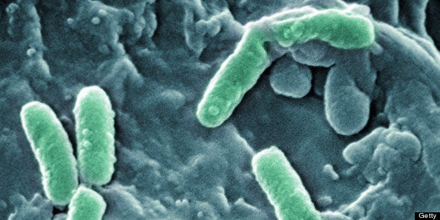 Scanning Electron Micrograph of Pseudomonas aeruginosa bacteria