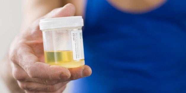 Male hand holding urine sample for drug test. Selective focus on cup.Related Images: