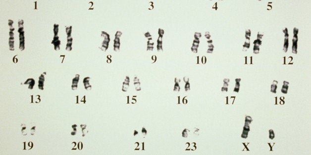 Y Chromosome Likely To Stop Shrinking Study Suggests Phew