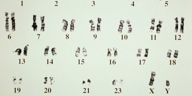 y chromosome