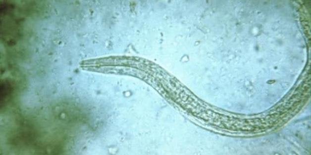 Multiple-drug resistant hookworms a growing threat