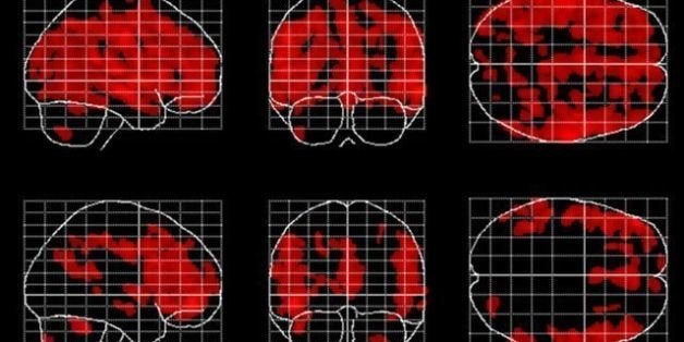 Impacts of Meditation on Brain