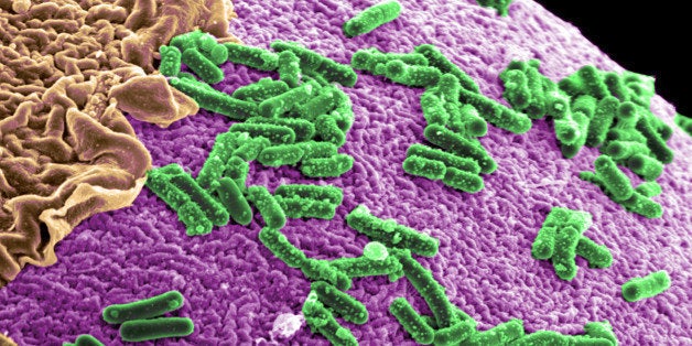 Scientists at PNNL are developing a model of the microbial environment inside the human gut. This model is composed of three-dimensional human intestinal cells cultured with specific gut bacteria. Changes in certain bacterial populations within the gut have been attributed to colon cancer, obesity, type 2 diabetes, and neurological diseases such as Alzheimerâs and Huntingtonâs diseases. The three-dimensional model provides an approach to study how changes in bacteria affect gut health and overall human health. Research was funded by the U.S. Department of Health and Human Services and PNNLâs Laboratory Directed Research and Development initiative in chemical imaging.Team Members from PNNL: Janine Hutchison, Alice Dohnalkova, Becky Hess, Helen Kreuzer and Timothy Straub. Image was colorized by Chad Marrington.Terms of Use: Our images are freely and publicly available for use with the credit line, "Courtesy of Pacific Northwest National Laboratory." Please use provided caption information for use in appropriate context.