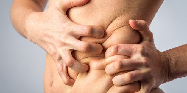 Nude female twisting the skin on her abdomen wth her hands.