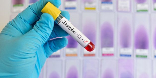 Blood sample positive with Chlamydia trachomatis bacteria