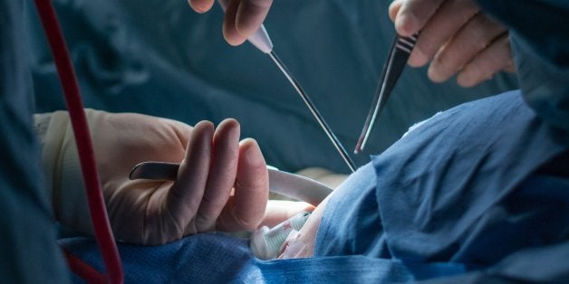 8 Myths About Transgender Mens Genital Reconstructions Huffpost 