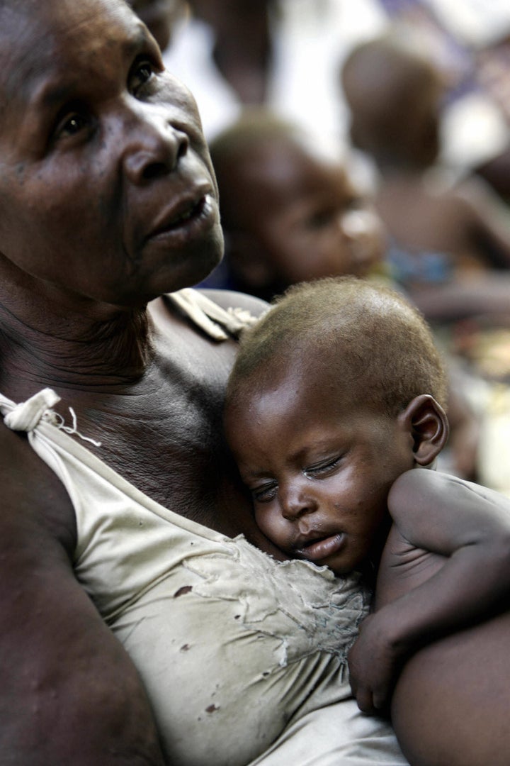 CHIKWAKWA, MALAWI: James, a 20-month-old Malawian malnourished childfrom Chikwakwa cries, 12 October 2005,in his grandmother's arms at the Mont Fort Hospital backyard in Chikwakwa, his mother dies of AIDS few months ago.Due to a severe drought that this year has hit Malawi, one of the poorest country in Africa, most of the land is dry and has not produced the expected quantity of maize. Aid agencies in Malawi are warning of a looming humanitarian crisis stemming from the double effect of drought that has cut output of maize, the staple food, by a quarter and AIDS. AFP PHOTO/GIANLUIGI GUERCIA (Photo credit should read GIANLUIGI GUERCIA/AFP/Getty Images)