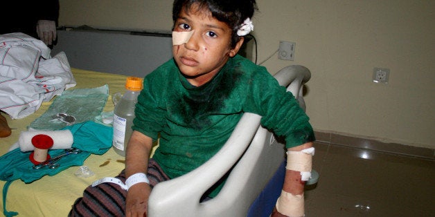 An injured Syrian child waits in a Turkish hospital in Kilis, southern Turkey after an explosion near the border of Syria-Turkey in Es-Selame City on February 20 , 2014 . A car bomb exploded near the Turkish-Syrian border, at least 6 people were killed. Injured people were transported to Turkish hospitals. AFP PHOTO/MEHMET ENGIN (Photo credit should read MEHMET ENGIN/AFP/Getty Images)