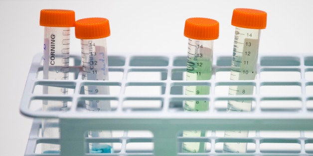 Test tubes used during a DNA sequencing experiment sit in a receptacle in a laboratory inside Nestle SA's Institute of Health