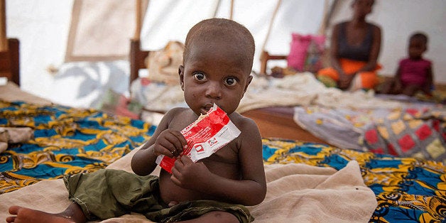 BANGUI, CENTRAL AFRICAN REPUBLIC - MARCH 5: Action Against Hunger (ACF) spokesman Lucille Grosjean states that number of the children in treatment center raised to 1200 in the capital Bangui, Central African Republic (CAR) on March 3, 2014. Local people living under difficult conditions are in need of clean water to drink and food. (Photo by Stringer/Anadolu Agency/Getty Images)