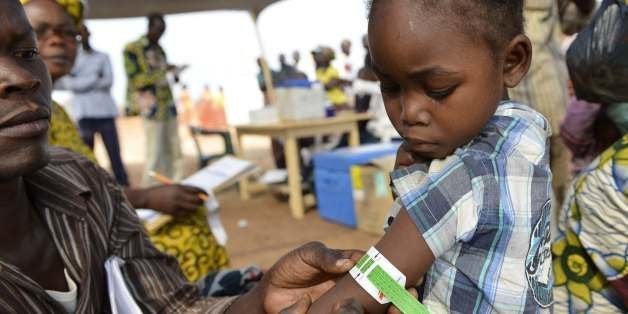 A man measures a child's arm circumference in a makeshift field clinic of the Doctors Without Borders (MSF) organisation duri