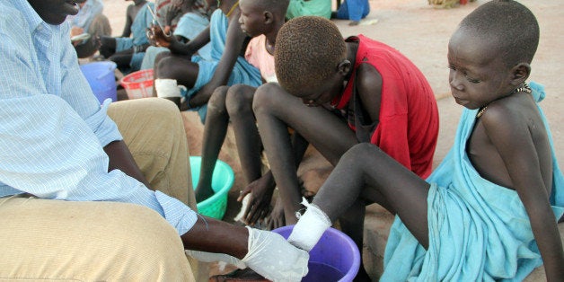 ** TO GO WITH SUDAN CARTER GUSANO ** In this Nov. 4, 2010 photo, Ajak Kuol Nyamchiek, 7, watches while John Lotiki, a nurse with the Carter Center, bandages the blister on her leg from where a guinea worm is slowly emerging in Abuyong, Sudan. Nyamchiek is a patient at Centerâs guinea worm case containment center. Nurses at this center in Abuyong, a village in Awerial County in Southern Sudanâs Lakes state, bandage the worms twice daily, after gently pulling the worms out several inches each time. If they break while they are being pulled out of the swollen blisters, the wounds become infected and the worms withdraw back into the body, prolonging the pain for the victims. (AP Photo/Maggie Fick)