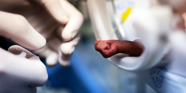 BLOEMFONTEIN, SOUTH AFRICA MARCH 11: (SOUTH AFRICA OUT) A newborn baby at the Kangaroo Mother Care Centre at Pelonomi Hospital on March 11, 2014 in Bloemfontein, South Africa. The Kangaroo Mother Care Centre helps women who deliver premature babies across the Free State province to take care of their babies until they are fully developed. Kangaroo care is a technique practiced on premature babies, wherein the infant is held, skin-to-skin, with an adult. The concept was initially developed to care for premature babies in areas where incubators are either unavailable or unreliable. (Photo by Conrad Bornman/Gallo Images/Getty Images)