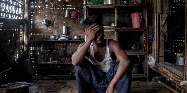 SITTWE, BURMA - MAY 25: Noor Alerm, 23 years, was held captured by human traffickers at sea for 3 months, May 25, 2015 in Sittwe, Burma. Since 2012, the minority group of the Rohingya people are forced to live in IDP camps, in Rakhaing State in western Burma. They have been denied citizenship in their homeland Burma and are accused of being illegal migrants from neighbouring Bangladesh. Thousands of Rohingays try to escape the misery in the IDP camps across the Andaman Sea on small fishing boats hoping to reach Malaysia. Many of those who embark on the perilous journey by sea fall into the hands of human traffickers who charge high prices in return for their freedom. (Photo by Jonas Gratzer/Getty Images)