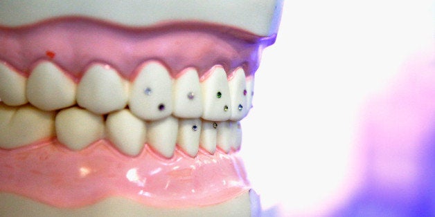 LONDON, ENGLAND - OCTOBER 03: A general view of tooth jewelry during the Olympia Beauty conference at Olympia on October 3, 2015 in London, England. (Photo by Julia Galleway/Getty Images)