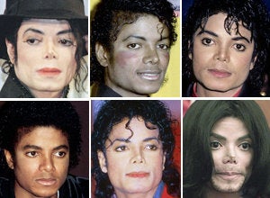 michael jackson nose before and after