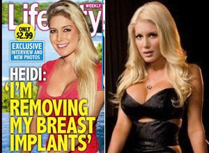 Heidi Montage before and after DDD boob job