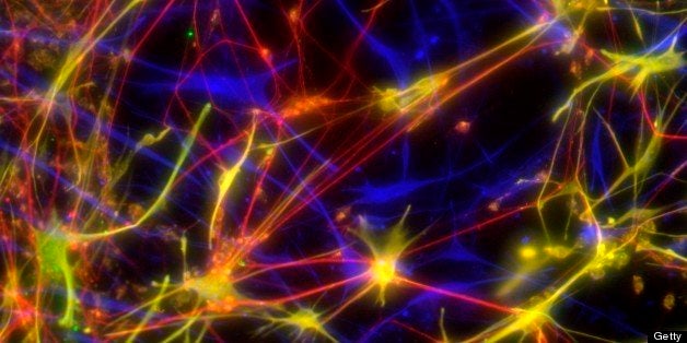 Stem cell-derived nerve cells. Fluorescence light micrograph of neural (nerve) stem cells that have been derived from human e