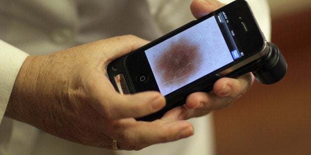 MIAMI, FL - JUNE 15: Doctor Antonella Tosti, Dermatologist University of Miami School of Medicine, displays an image on her iphone of a mark on the skin of Michael Casa Nova, 12, as she uses it as a dermatoscope while examinging him for symptoms of skin cancer due to sun exposure on June 15, 2011 in Miami, Florida. The federal Food and Drug Administration announced that sunscreen manufacturers are to change the labels on their products to prohibit the use of certain marketing terms. The new rules are meant to help clear up confusion about the meaning of 'sun protection factor,' or SPF, and other terms like 'waterproof.' (Photo by Joe Raedle/Getty Images)