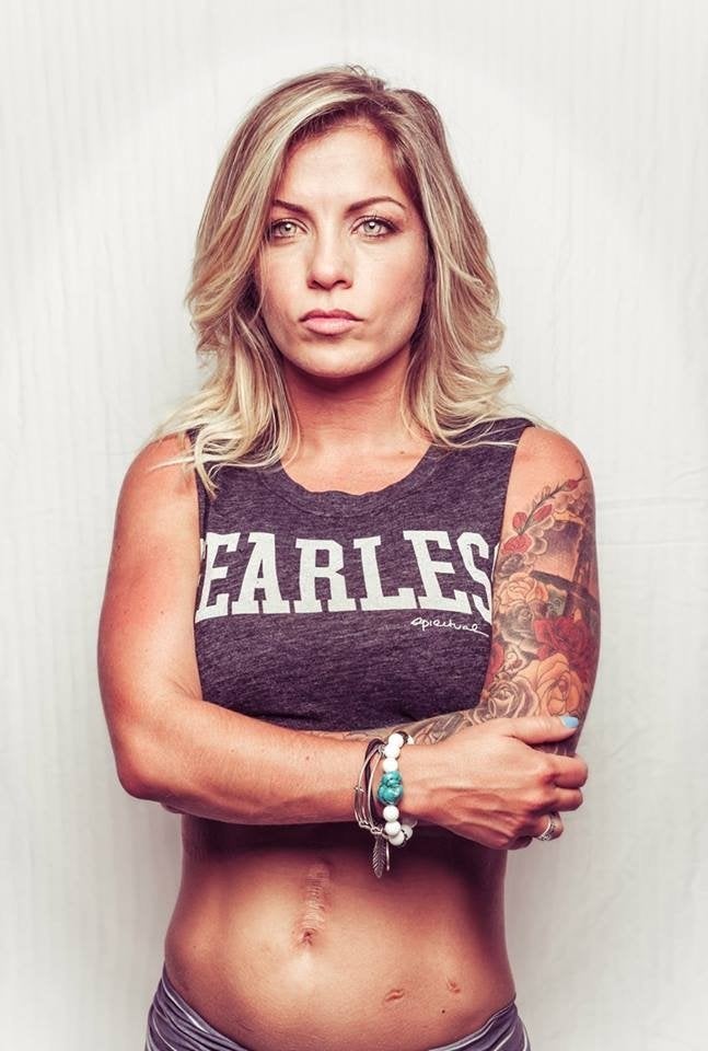 <em>"I was born with a genetic disease called, Cystic Fibrosis. Early on in my life, I was diagnosed at 18-months, they teach
