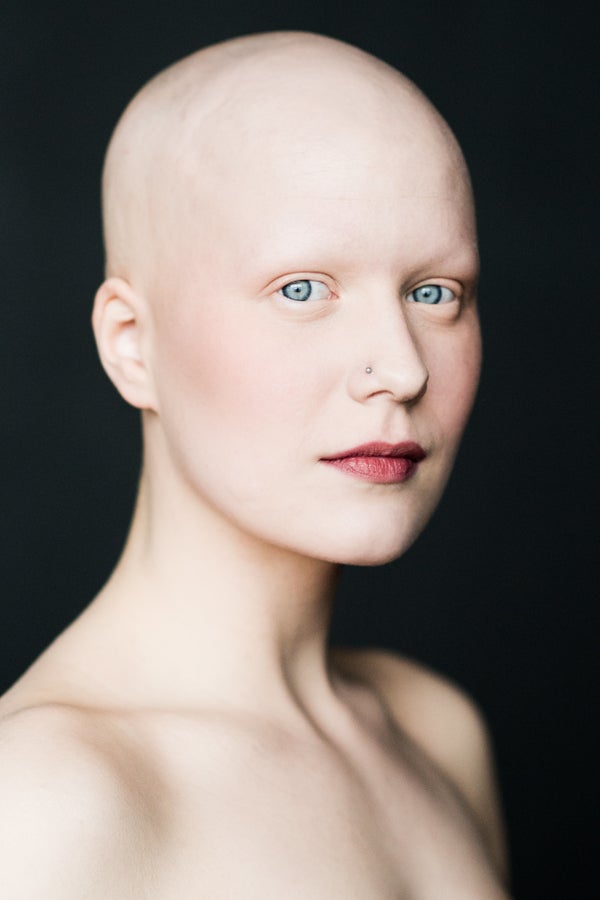 7 Stunning Portraits Of Women With Alopecia Redefine Femininity Huffpost