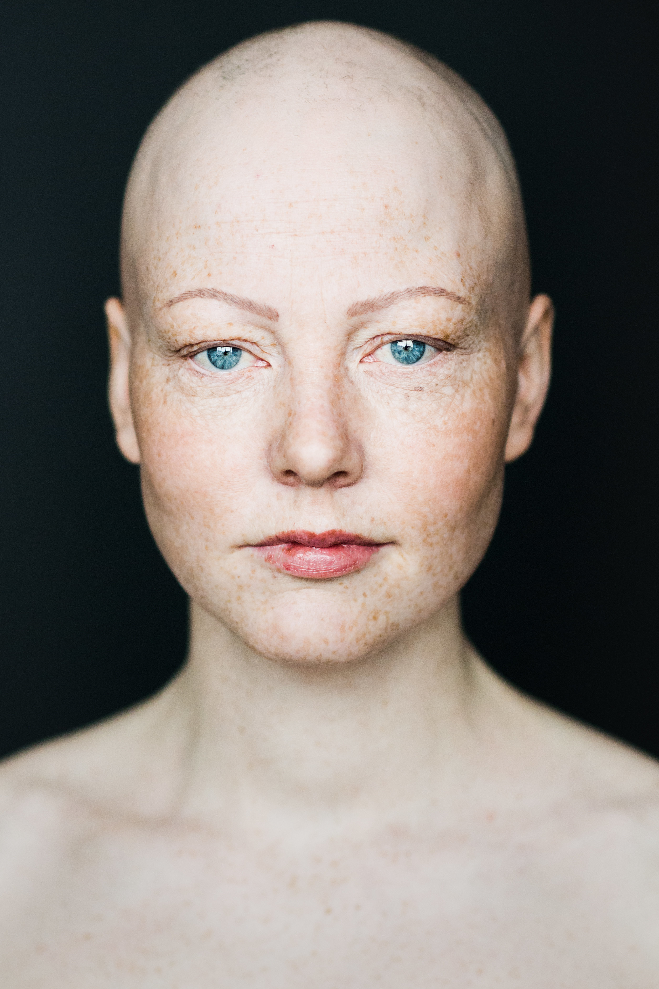 7 Stunning Portraits Of Women With Alopecia Redefine Femininity | HuffPost