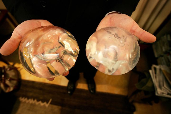 Kristen Stewart Got Breast Implants, Plastic Surgeons Believe