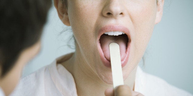 Doctor holding down woman's tongue with tongue depressor