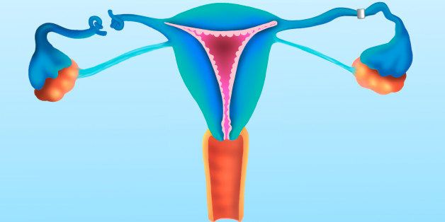 Surgery Of The Uterine Tubes May Be Proposed For Female Sterilization. The Tubes May Be Sectioned Or Occluded With A Clip Or Ring. Laparoscopy Is The Most Common Method. The Ovaries Continue To Function Normally Enabling A Normal Menstrual Cycle But The Female Eggs Cannot Be Fertilized. Female Sterility Is Generally Irreversible After Tube Surgery (Photo By BSIP/UIG Via Getty Images)