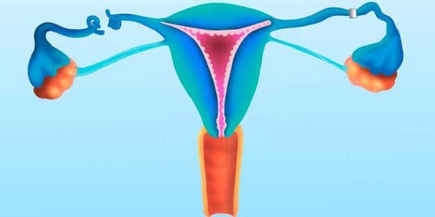 Surgery Of The Uterine Tubes May Be Proposed For Female Sterilization. The Tubes May Be Sectioned Or Occluded With A Clip Or Ring. Laparoscopy Is The Most Common Method. The Ovaries Continue To Function Normally Enabling A Normal Menstrual Cycle But The Female Eggs Cannot Be Fertilized. Female Sterility Is Generally Irreversible After Tube Surgery (Photo By BSIP/UIG Via Getty Images)