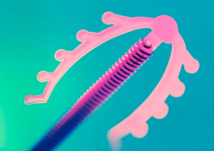 Doctors have said hormonal IUDs can lead to acne breakouts in women.