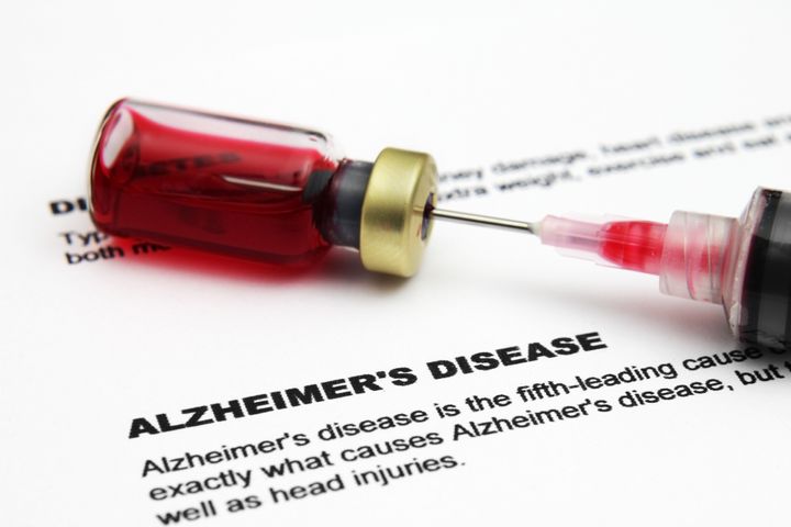 alzheimer disease