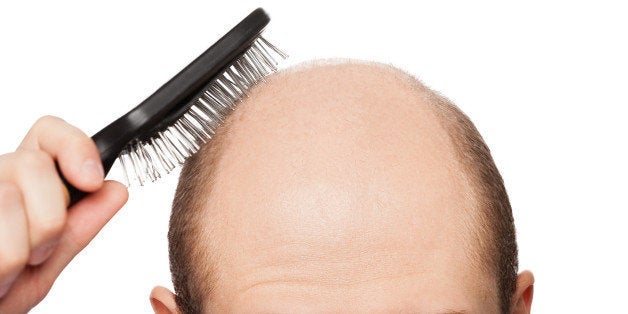 The Truth About Hair Loss And Baldness Cures | HuffPost Post 50 The Truth About Hair Loss And Baldness Cures | HuffPost Post 50