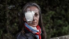 Woman Whose Eye Exploded After Being Hit With Golf Ball Criticizes Ryder Cup Officials
