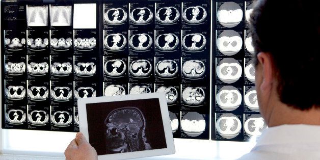 Doctor examining MRI scans with a digital tablet