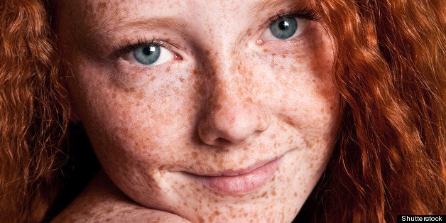Cheerful freckled girl